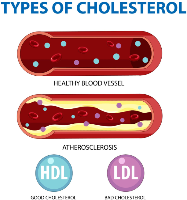 Knowing the types of cholestrol