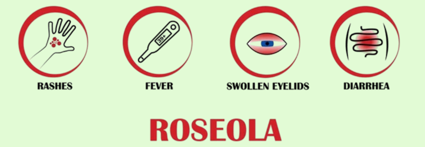 roseola