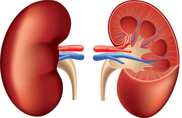 kidney cancer